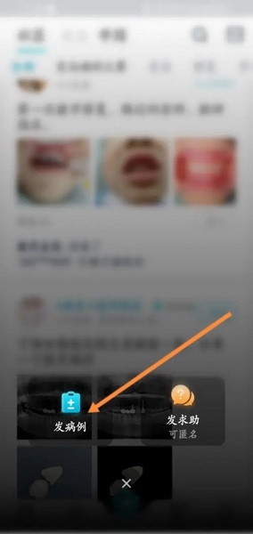 e看牙app怎么发表病例3
