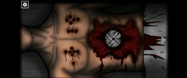 遗忘之丘手术室游戏攻略截图16